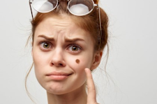 Do This Immediately if You Have Moles or Skin Tags