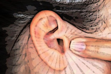 Simple Method Ends Tinnitus (Ear Ringing) - It's Genius!