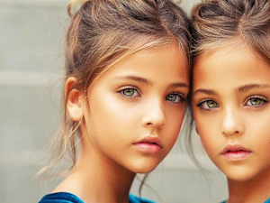 These Twins Were Named "Most Beautiful in the World," Wait Till You See Them Now