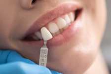 Dental Implants Paid for by Medicare