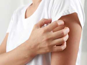 What Causes Psoriatic Arthritis? It's Not What Most People Think