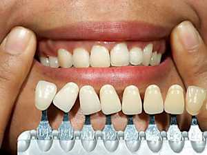 Peoria: Actual Whole Mouth Dental Implant Cost in 2022