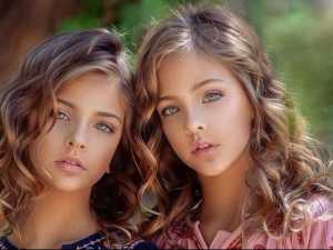 These Twins Were Named "Most Beautiful in the World" Wait Till You See Them Now