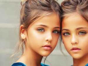 These Twins Were Named "Most Beautiful in the World," This is Them Today