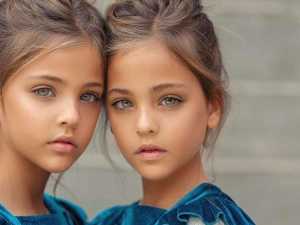 These Twins Were "Most Beautiful in the World," Wait Until You See Them Today