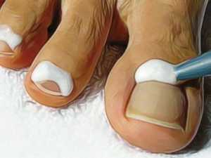 Doctor: if You Have Toenail Fungus, Do This Immediately (Genius!)