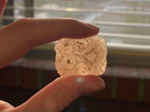 Dentists Shocked: Basic Mineral Stops Teeth Falling Out & Rebuild Gums