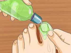Try This Tonight if You Have Nail Fungus (Watch)