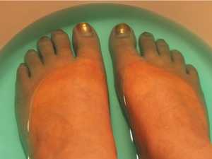 Have Toenail Fungus? Do This Immediately (Watch)