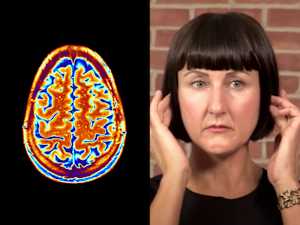 [Tinnitus Sufferers] MIT Brain Scan Reveals Longterm Effects If Untreated