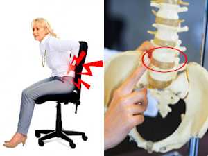 Anyone with Back Pain Should Watch This [Chiropractors Hate This]