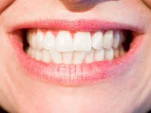 This Good Bacteria will Whiten Your Teeth at Home (Watch Video)