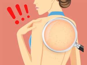 4 Warning Signs Of Damaged Liver (#2 Is Scary)