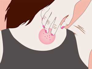 How Your Body Warns You That Liver Disease is Forming