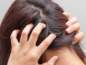 What Causes Psoriatic Arthritis? It's Not What Most People Think