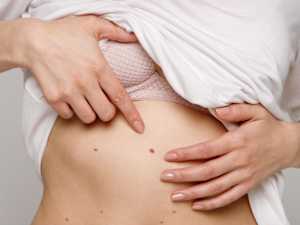 First Hints of Metastatic Breast Cancer Every Woman Should Know