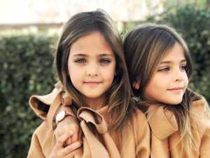 These Twins Were Named "Most Beautiful in the World," Wait Till You See Them Now