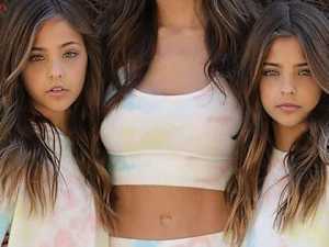 9 Years Ago They Were Called the World's Most Beautiful Twins - Now Look at Them