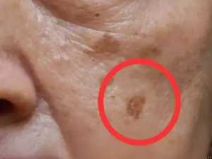 MD: If You Have Dark Spots, Do This Immediately (It's Genius!)