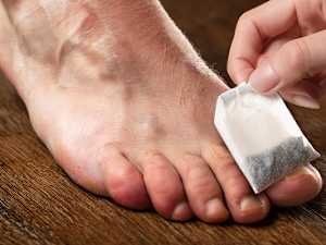 Shocking Report: 7 Everyday Items That Can Cause Nail Fungus