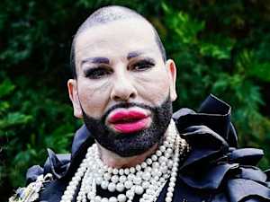 He Was a Famous Actor Before His Plastic Surgery, Guess Who is He