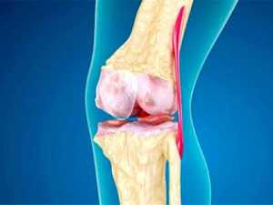 Start Doing This Everyday to Reduce Joint Pain (Watch)