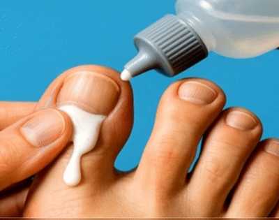 If You Have Toenail Fungus Try This Tonight (It's Genius)