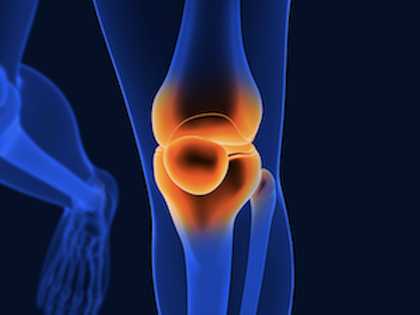 Bone on Bone? Do This Once a Day for New Knees, Says Top Doc