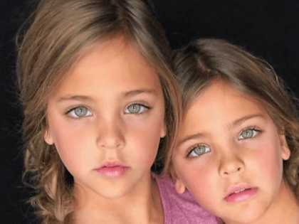 They Were Named the Most Beautiful Twins in the World, Wait Till You See Them to