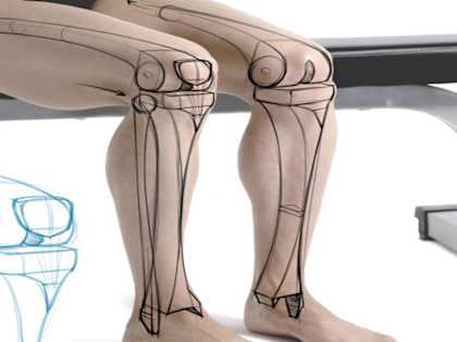 Doctor's #1 Piece of Advice for Bad Knees (Try This Tonight)