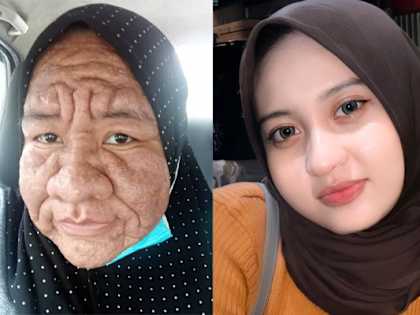 68-Year-Old Woman From Tagum With Baby Face. See What She Does