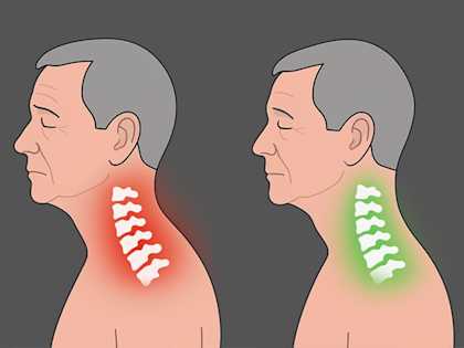 Top Doctor Begs: Fix This Side Sleeper Habit or Risk Arthritis
