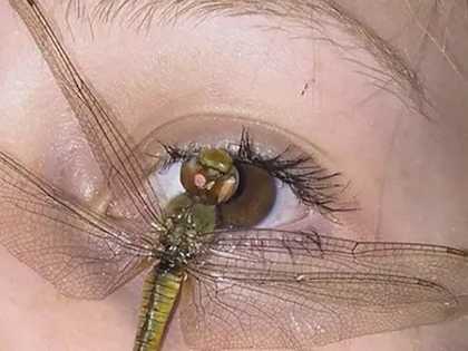 Eye Surgeon: Do This to Restore Eyesight (Watch Video)