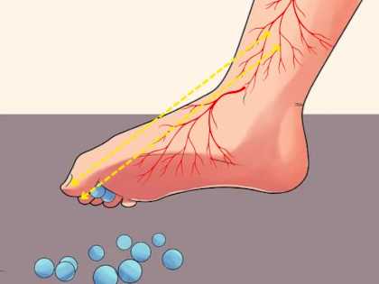 Neuropathy: Relieve 'Needle Pain' & Numbness - Try This at Home Today