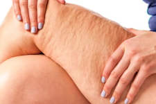 The 1 Household Item That Visibly Tightens Saggy Skin