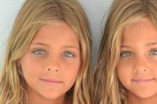 9 Years Ago They Were Called the World's Most Beautiful Twins - Now Look at Them