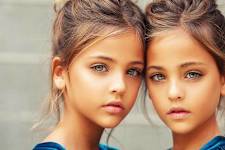 9 Years Ago They Were Called the World's Most Beautiful Twins - Now Look at Them