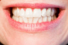 Whiten Your Teeth at Home with This 60 Second Ritual (Watch Video)