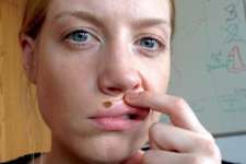 Moles and Skin Tags Fall Right off After Doing This