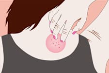 7 Signs You Need a Parasite Cleanse (Check It at Home)