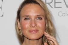 40 Celebrities That Actually Look Worse After a Plastic Surgery Than Before