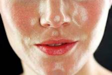 Doctors Stunned: This Removes Wrinkles and Eye-bags Like Crazy! (Try Tonight)