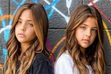 These Twins Were Named "Most Beautiful in the World" Wait Till You See Them Now