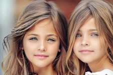 9 Years Ago They Were Called the World's Most Beautiful Twins - Now Look at Them