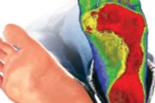 Neuropathy: Simple Method Helps Nerve Pain Disappear (At Home)