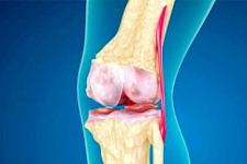 Doctors Baffled: Simple Tip Relieves Years of Joint Pain and Arthritis