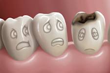 Defeat Gum Disease or Tooth Decay Instantly -Uncover The Genius!