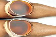 6 Ways to Get Relief from Joint Pain Naturally
