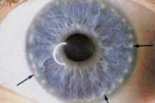 Eye Surgeon: Do This to Restore Eyesight (20/20 Vision)