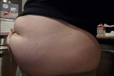 Bariatrician Stunned: Forget Ozempic, This "Fixes" Your Hanging Belly! Try It!